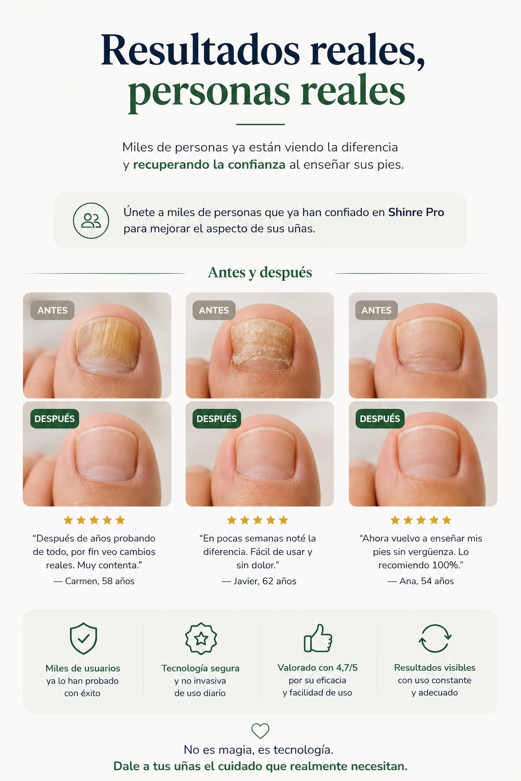 Dispositivo Láser para Hongos en las Uñas